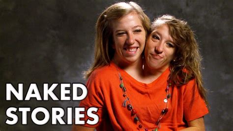 conjoined twins naked|conjoined twins having sex Search